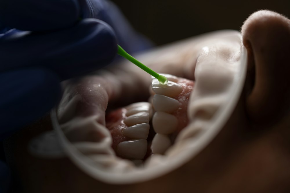 Sellado dental