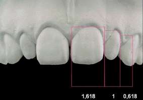Radiografía proporcion aurea dental